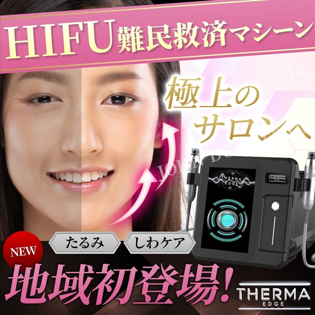 古河市ミエーレのサーマエッジによるリフトアップ