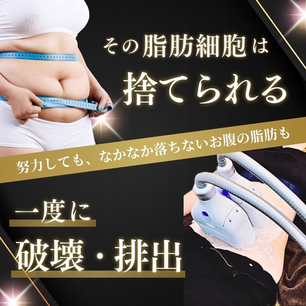古河市ミエーレの痩身・脂肪冷却